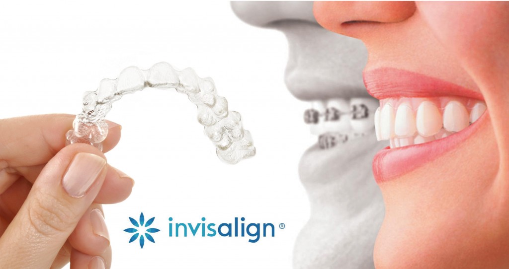 invisalign